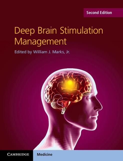Produktbild: Deep Brain Stimulation Management