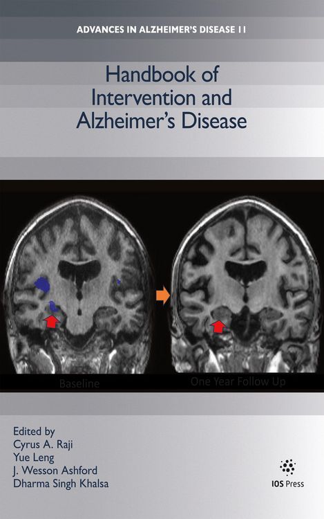 Produktbild: Handbook of Intervention and Alzheimer's Disease