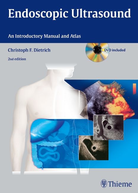 Produktbild: Endoscopic Ultrasound