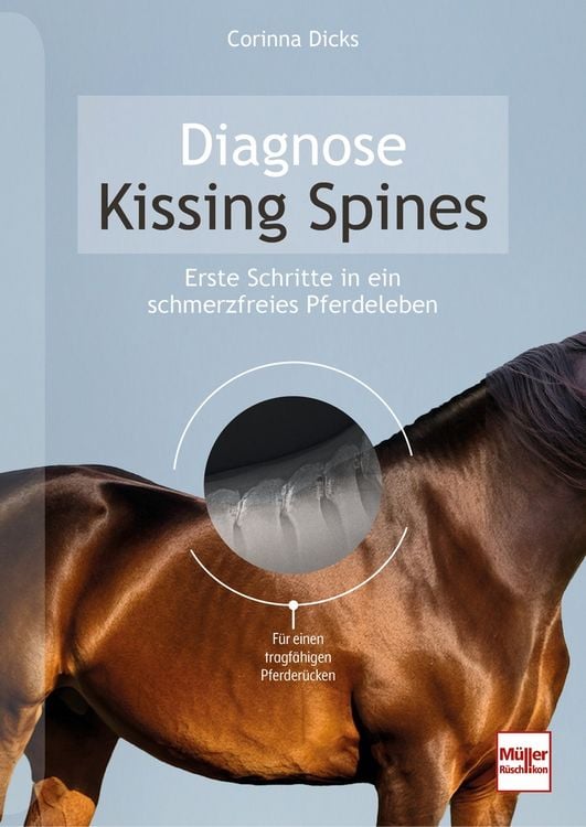 Produktbild: Diagnose Kissing Spines