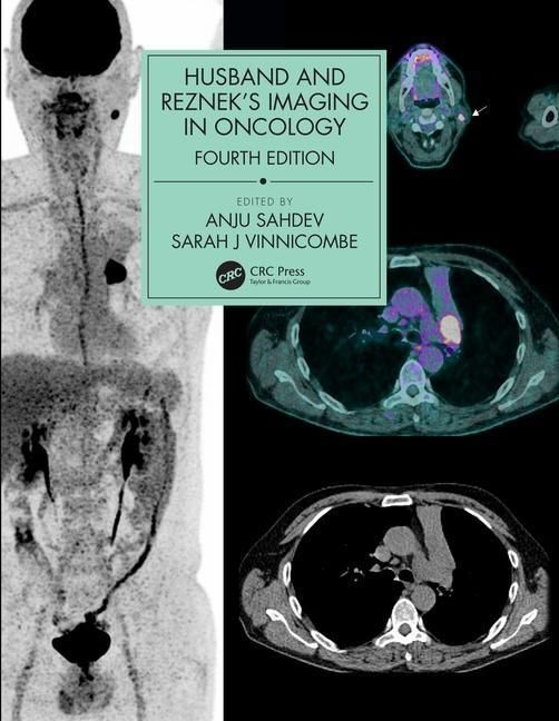 Produktbild: Husband & Reznek's Imaging in Oncology