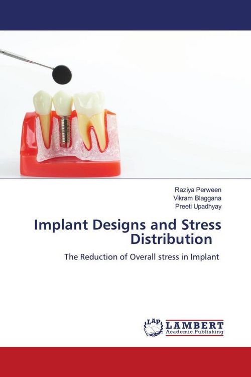 Produktbild: Implant Designs and Stress Distribution