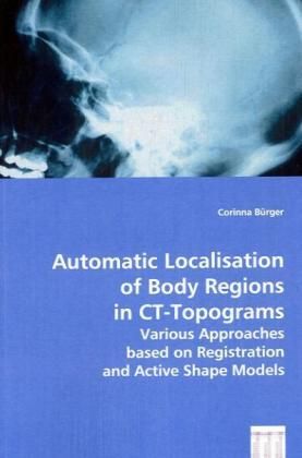 Produktbild: Lokalisierung von K&ouml;rperregionen in CT-Topogrammen
