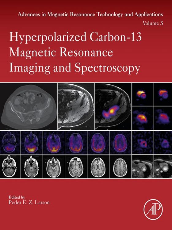 Produktbild: Hyperpolarized Carbon-13 Magnetic Resonance Imaging and Spectroscopy