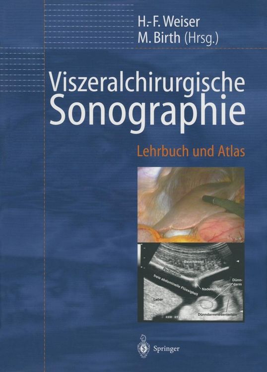 Produktbild: Viszeralchirurgische Sonographie