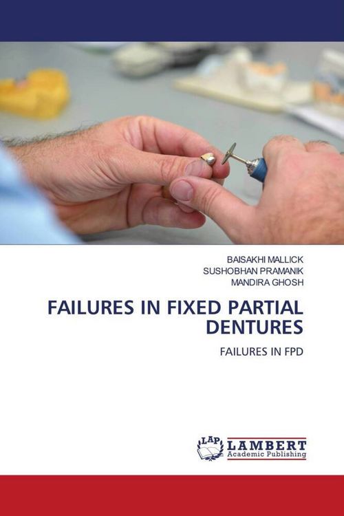 Produktbild: FAILURES IN FIXED PARTIAL DENTURES