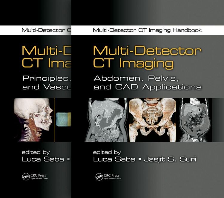 Produktbild: Multi-Detector CT Imaging Handbook, Two Volume Set