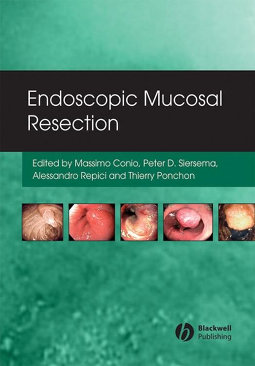 Produktbild: Endoscopic Mucosal Resection