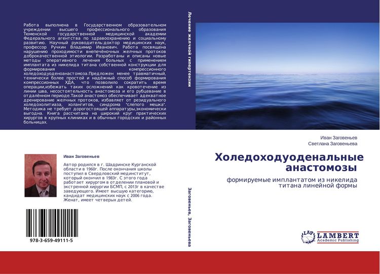 Produktbild: Holedohoduodenal'nye anastomozy
