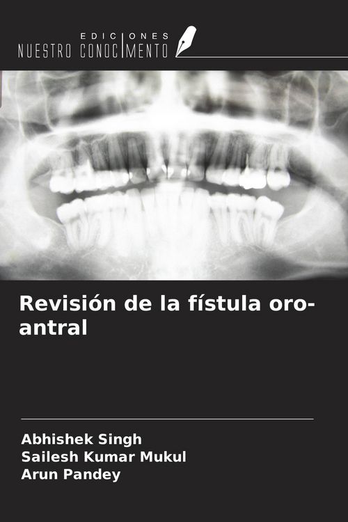 Produktbild: Revisi&oacute;n de la f&iacute;stula oro-antral
