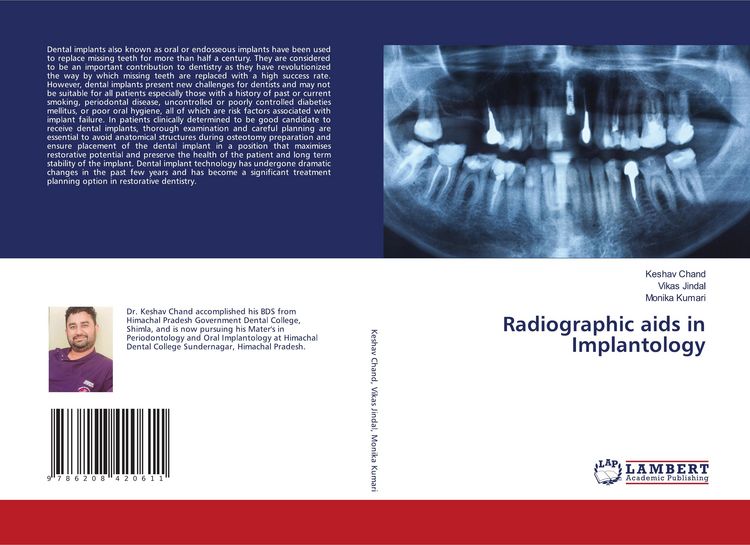 Produktbild: Radiographic aids in Implantology