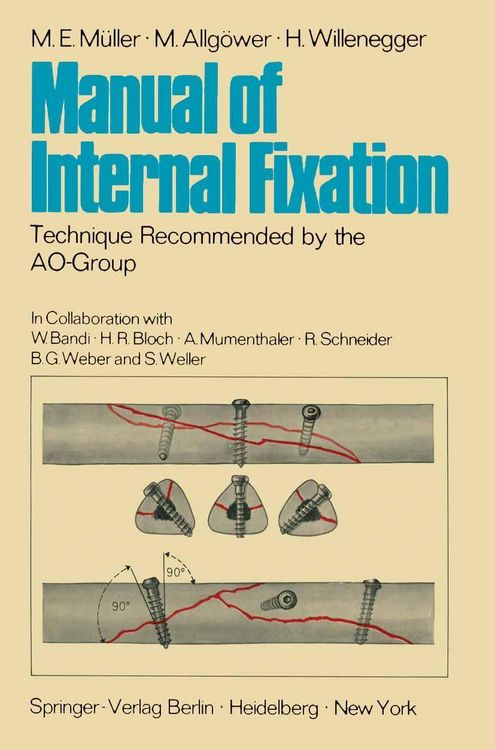 Produktbild: Manual of Internal Fixation