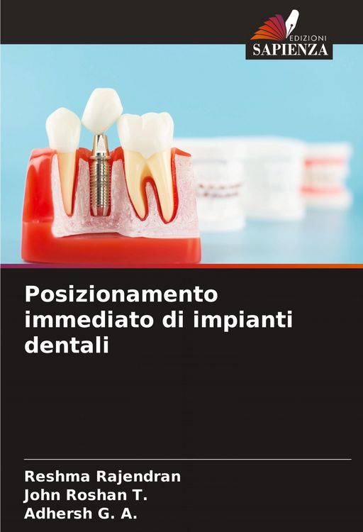 Produktbild: Posizionamento immediato di impianti dentali