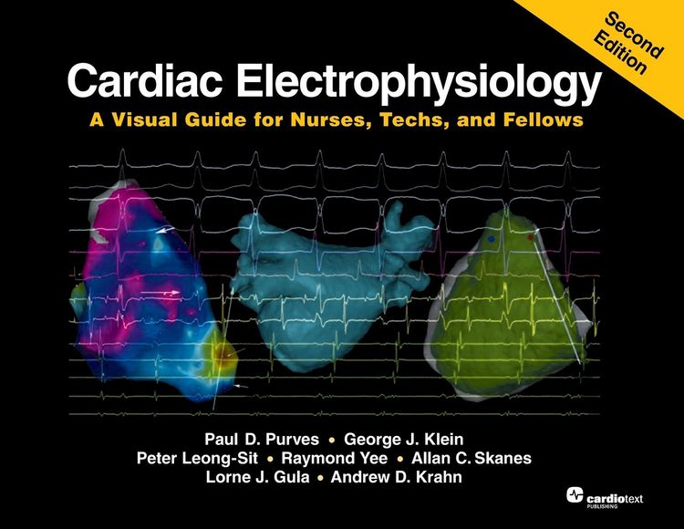 Produktbild: Cardiac Electrophysiology
