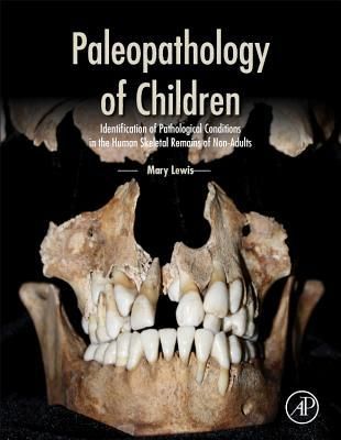 Produktbild: Paleopathology of Children
