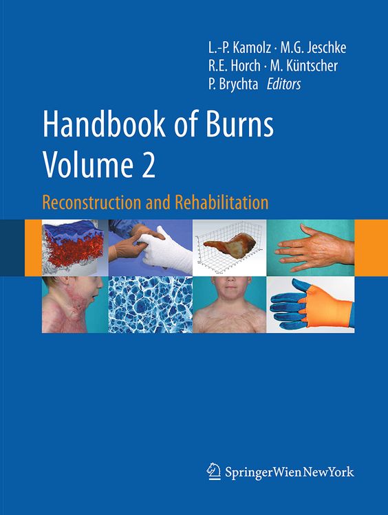 Produktbild: Handbook of Burns Volume 2