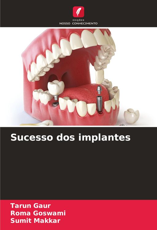 Produktbild: Sucesso dos implantes