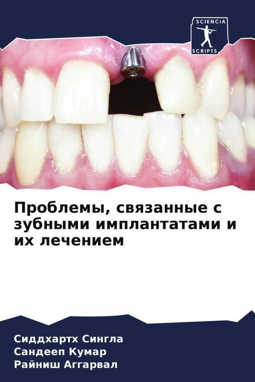 Produktbild: Problemy, swqzannye s zubnymi implantatami i ih lecheniem