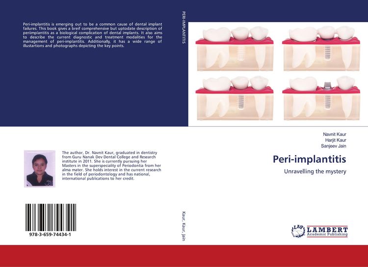 Produktbild: Peri-implantitis