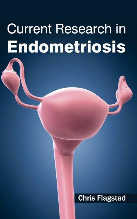Produktbild: Current Research in Endometriosis