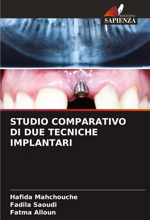 Produktbild: Studio Comparativo Di Due Tecniche Implantari