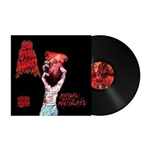 Produktbild: Manual Manic Procedures (180g black vinyl)