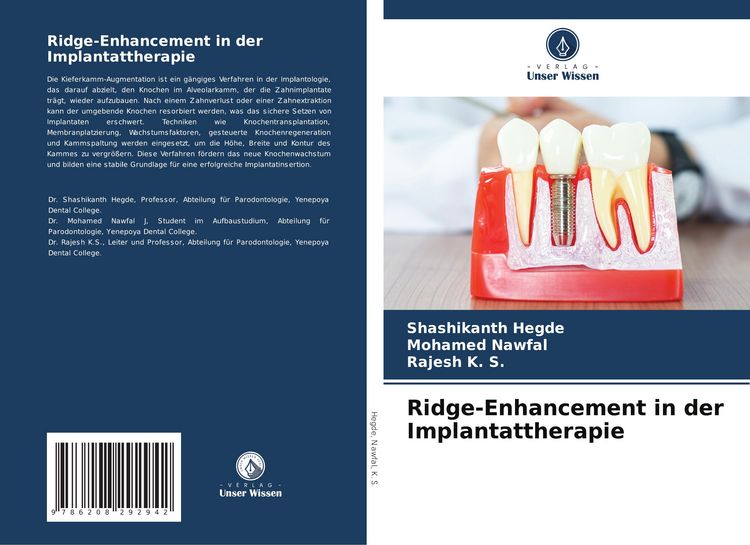 Produktbild: Ridge-Enhancement in der Implantattherapie