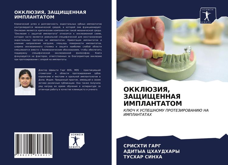 Produktbild: Okkljuziya, Zashhishhennaya Implantatom
