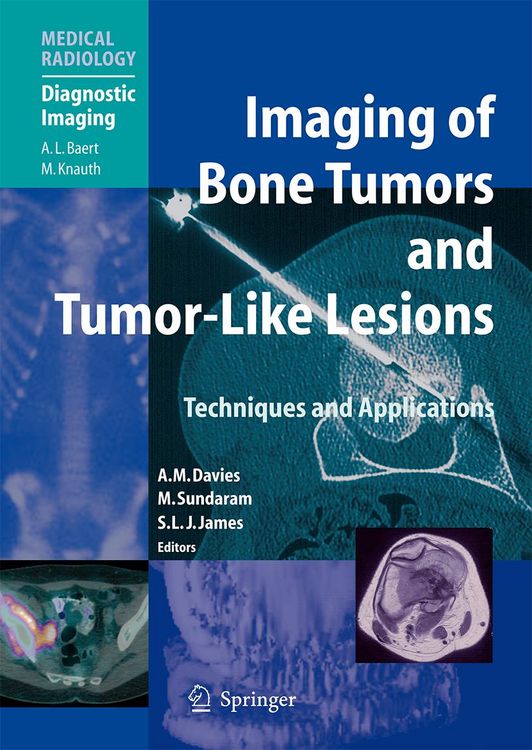 Produktbild: Imaging of Bone Tumors and Tumor-Like Lesions
