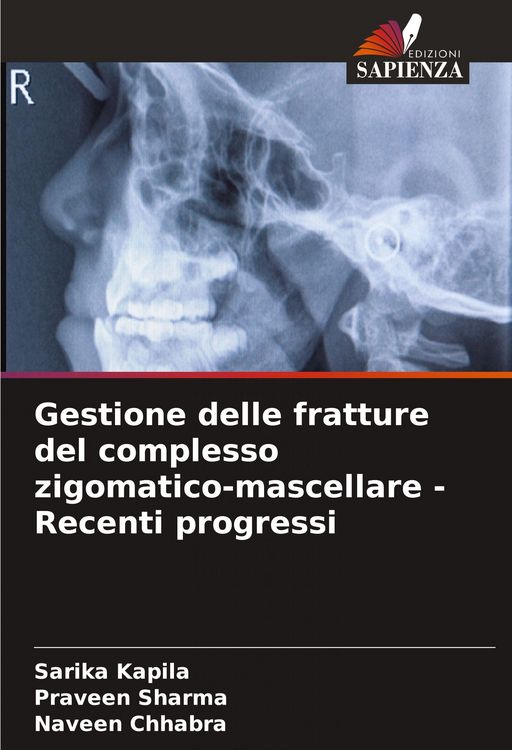 Produktbild: Gestione delle fratture del complesso zigomatico-mascellare - Recenti progressi
