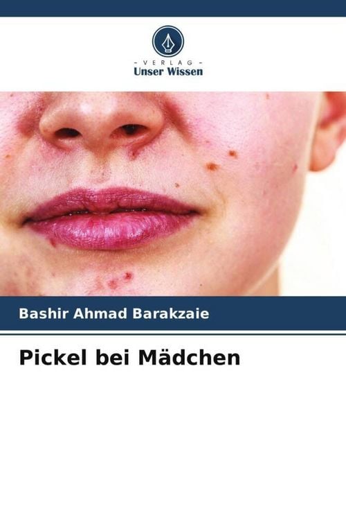 Produktbild: Pickel bei M&auml;dchen