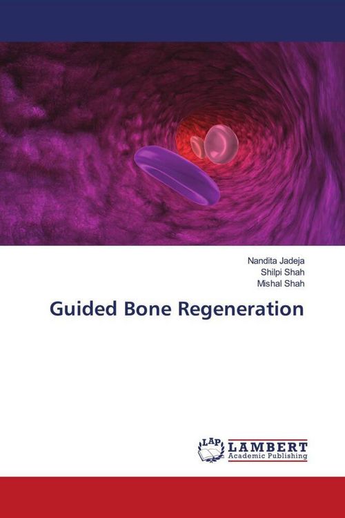 Produktbild: Guided Bone Regeneration