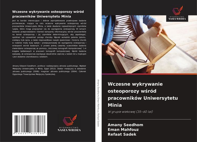 Produktbild: Wczesne wykrywanie osteoporozy w&iquest;r&oacute;d pracownik&oacute;w Uniwersytetu Minia