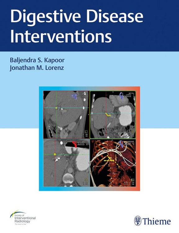 Produktbild: Digestive Disease Interventions