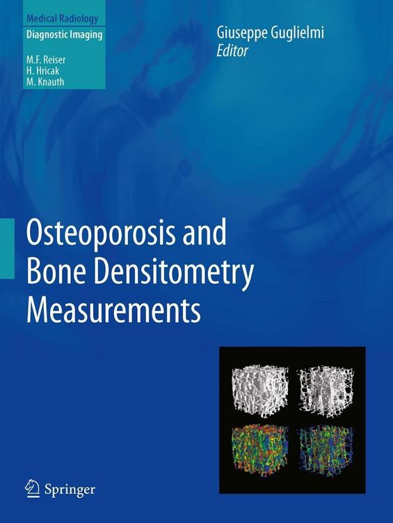 Produktbild: Osteoporosis and Bone Densitometry Measurements