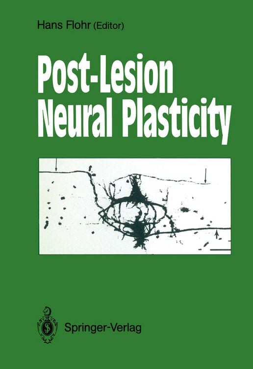 Produktbild: Post-Lesion Neural Plasticity