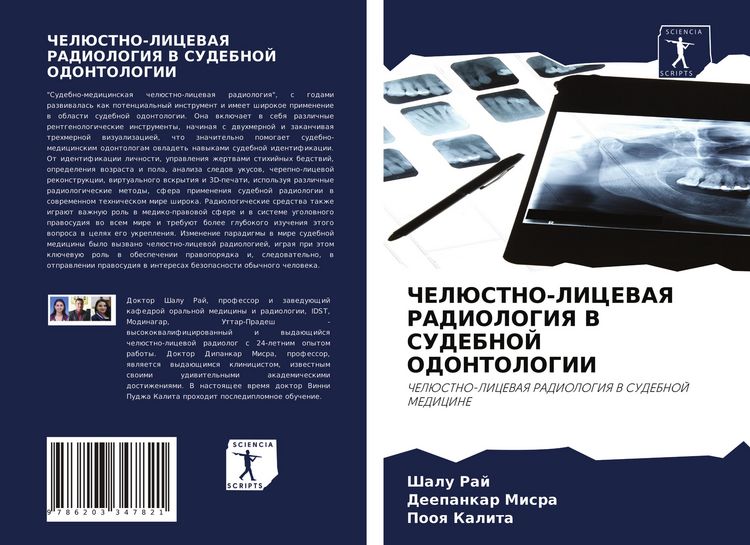Produktbild: Cheljustno-Licevaya Radiologiya V Sudebnoj Odontologii
