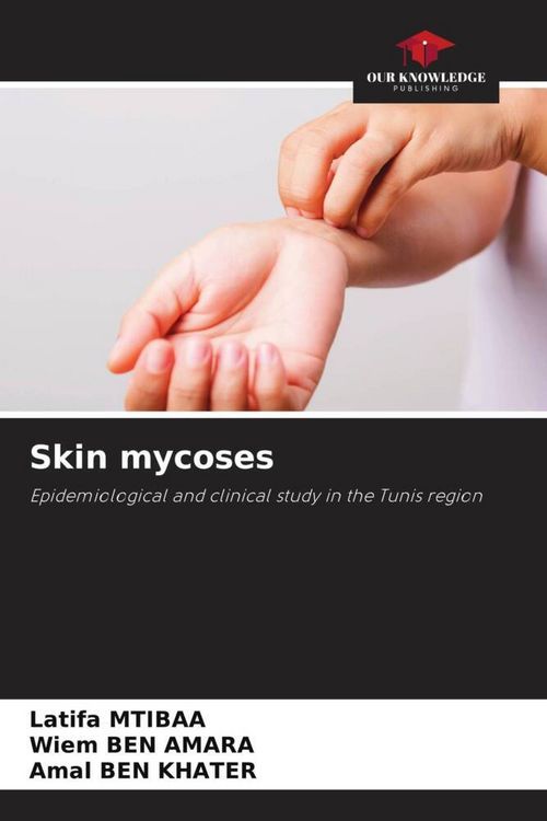 Produktbild: Mtibaa, L: Skin mycoses