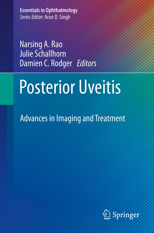 Produktbild: Posterior Uveitis