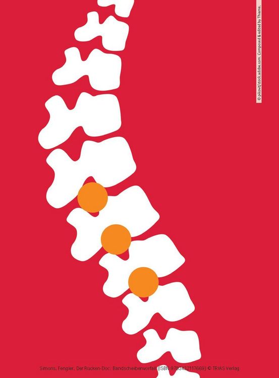 Produktbild: Der R&uuml;cken-Doc: Bandscheibenvorfall