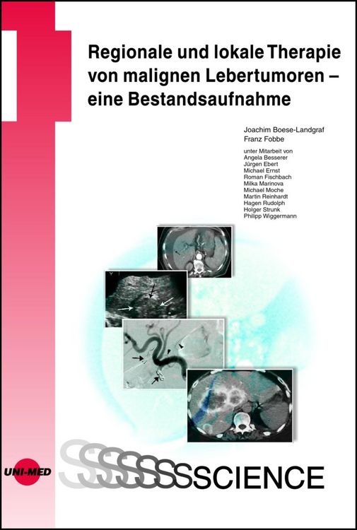 Produktbild: Regionale und lokale Therapie von malignen Lebertumoren - eine Bestandsaufnahme