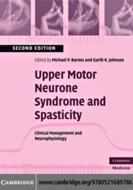 Produktbild: Upper Motor Neurone Syndrome and Spasticity