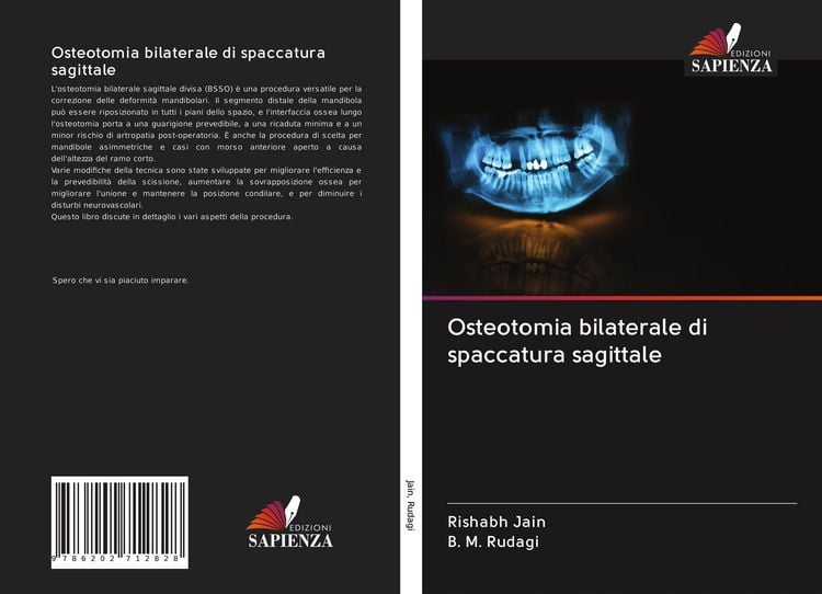 Produktbild: Osteotomia bilaterale di spaccatura sagittale