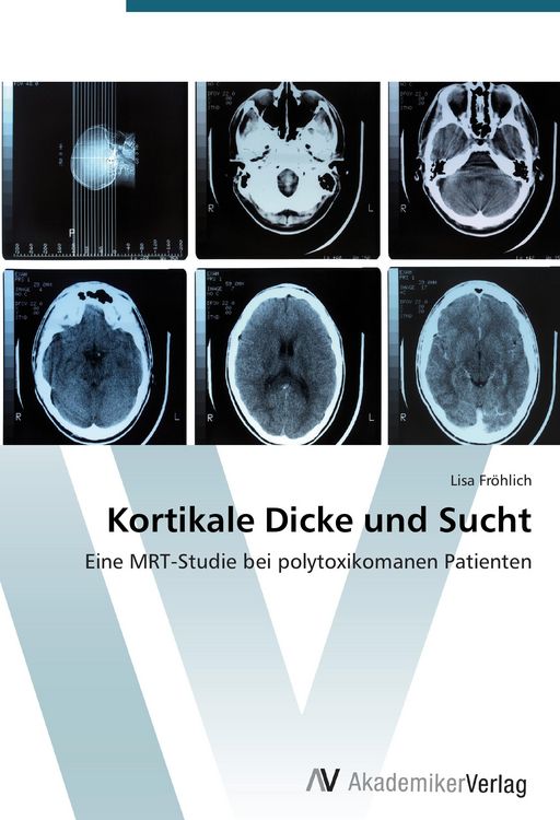 Produktbild: Kortikale Dicke und Sucht
