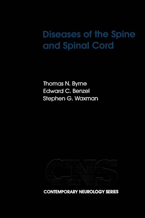 Produktbild: Diseases of the Spine and Spinal Cord