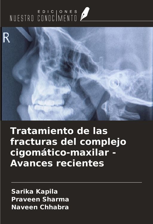 Produktbild: Tratamiento de las fracturas del complejo cigom&aacute;tico-maxilar - Avances recientes