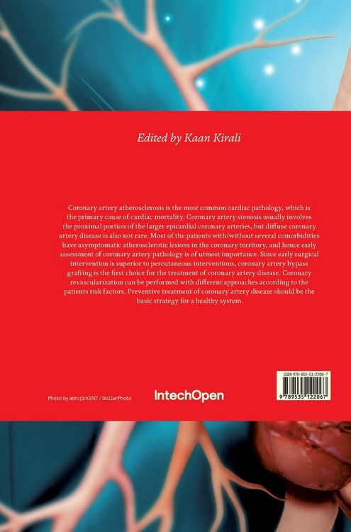 Produktbild: Coronary Artery Disease