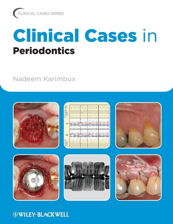 Produktbild: Clinical Cases in Periodontics