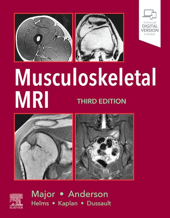 Produktbild: Musculoskeletal MRI E-Book
