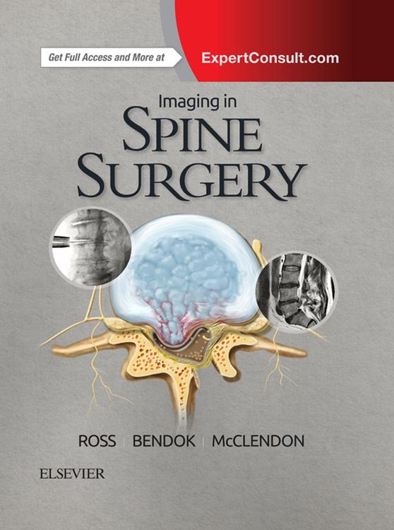 Produktbild: Imaging in Spine Surgery E-Book